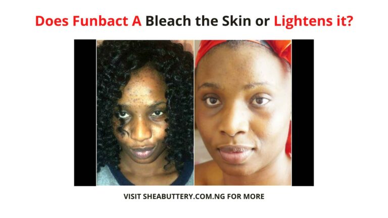 Does Funbact A Bleach the Skin